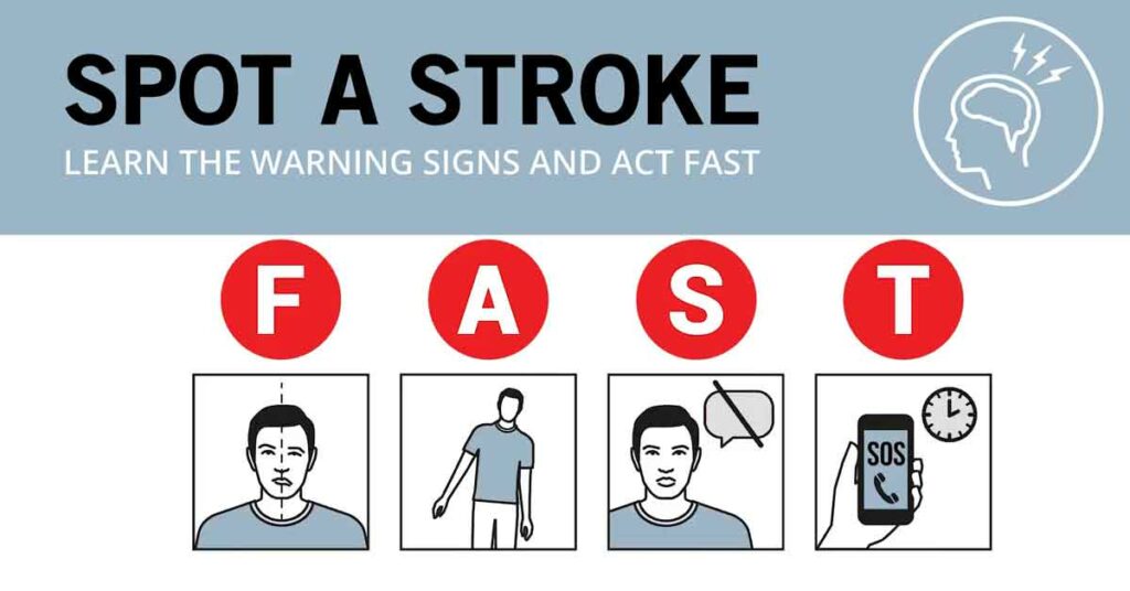Recognizing a Stroke FAST