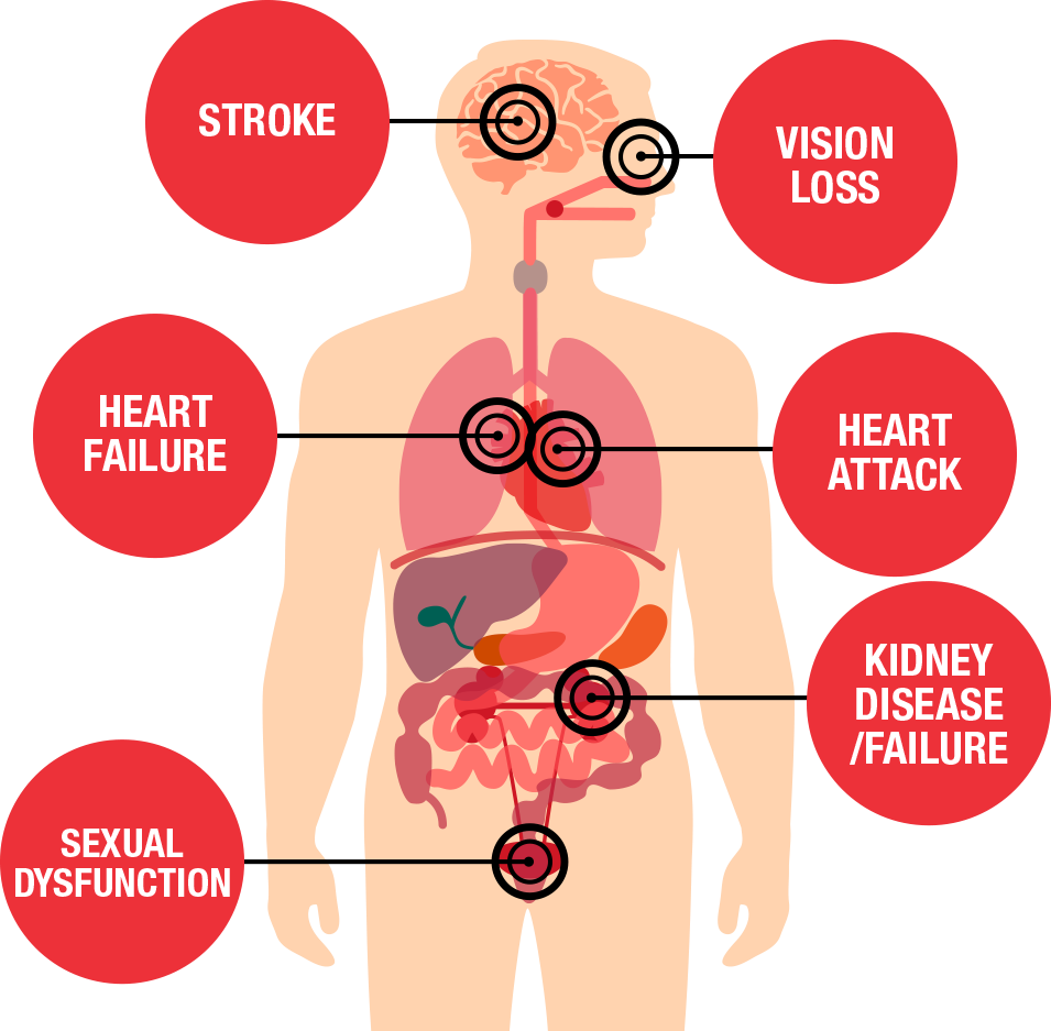 How to tell if your blood pressure is deals high