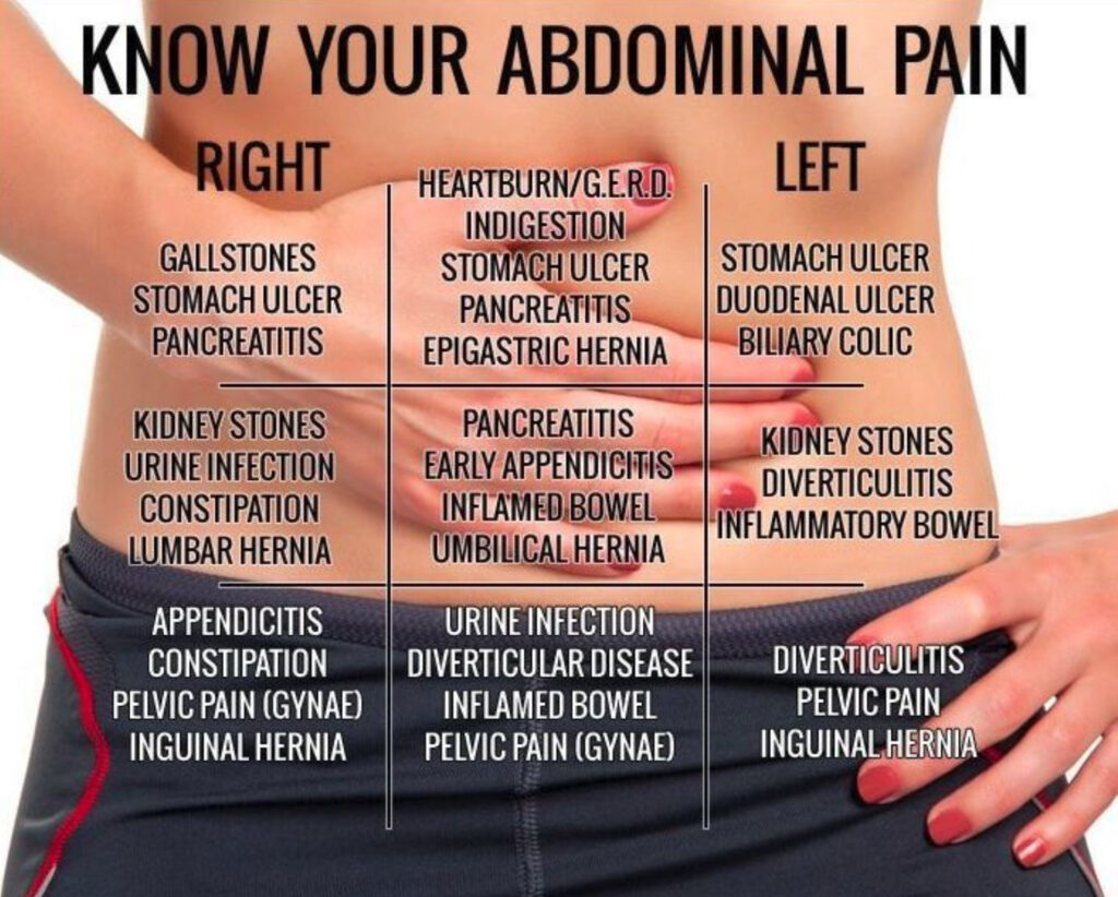 Know Your Abdominal Pain