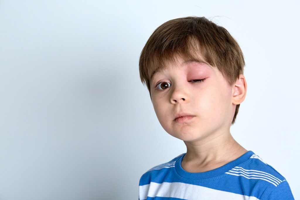 eye-injuries-when-to-go-to-the-er-elitecare-emergency-hospital