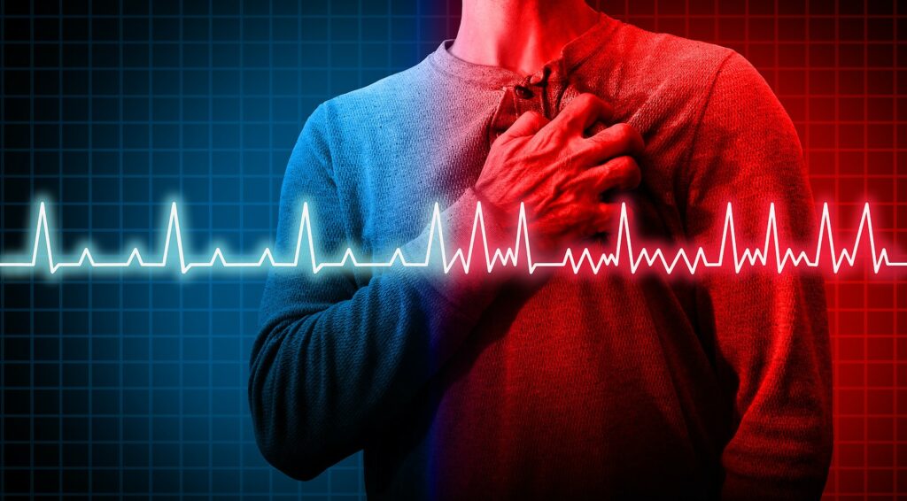 Atrial Fibrillation or AFib or Heart Flutters