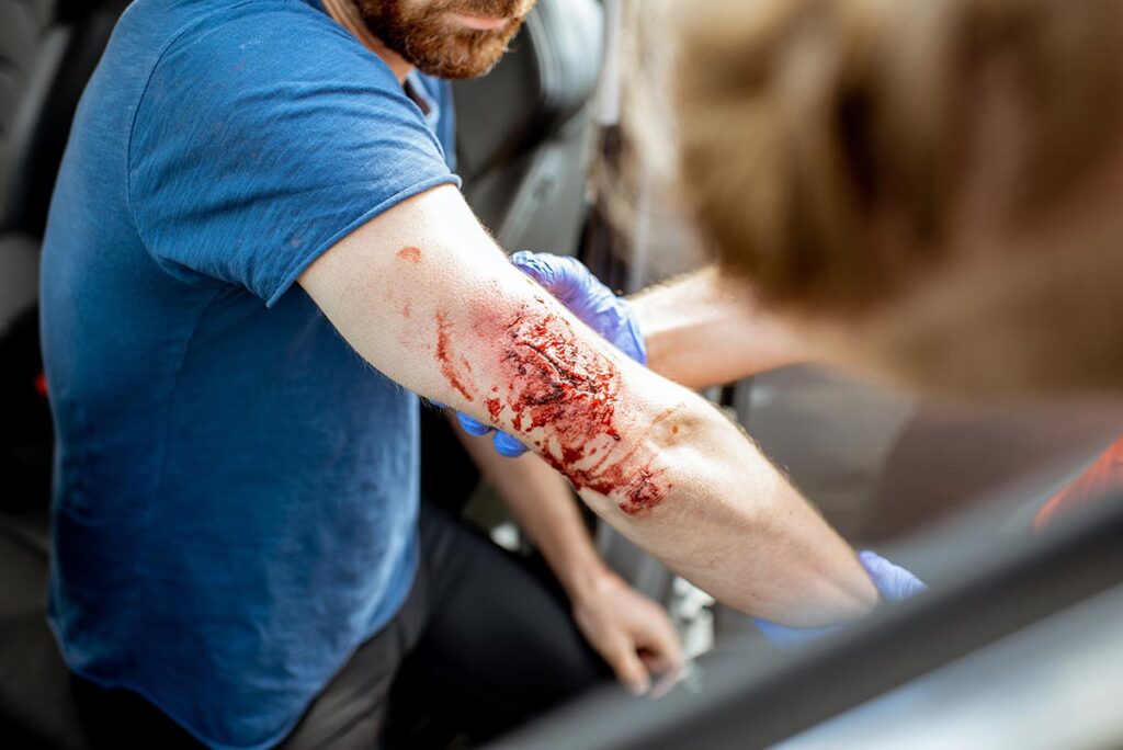 medic examining Cuts and Lacerations after the accident